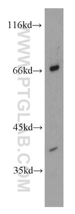 AMH Antibody in Western Blot (WB)