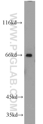 GLUD2 Antibody in Western Blot (WB)