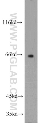 GLUD2 Antibody in Western Blot (WB)