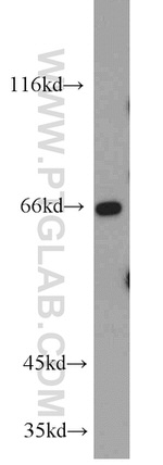 GLUD2 Antibody in Western Blot (WB)