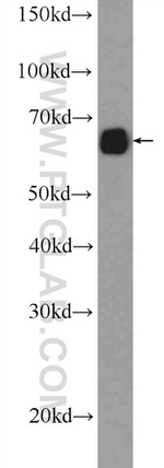 GLUD2 Antibody in Western Blot (WB)