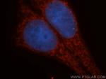 GLUD2 Antibody in Immunocytochemistry (ICC/IF)