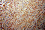 GLUD2 Antibody in Immunohistochemistry (Paraffin) (IHC (P))