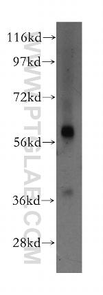 GLUD2 Antibody in Western Blot (WB)