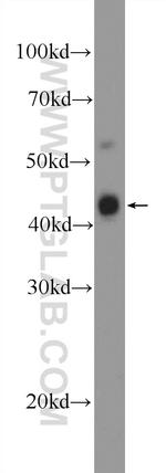 TCF7 Antibody in Western Blot (WB)
