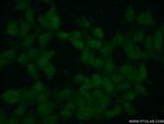 SMC6 Antibody in Immunocytochemistry (ICC/IF)