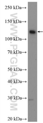 SMC6 Antibody in Western Blot (WB)
