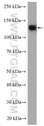SMC6 Antibody in Western Blot (WB)