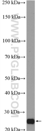 AIG1 Antibody in Western Blot (WB)