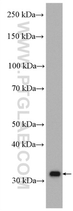 AIG1 Antibody in Western Blot (WB)