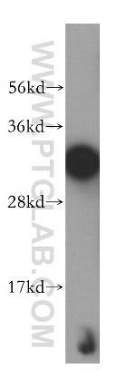 AIG1 Antibody in Western Blot (WB)
