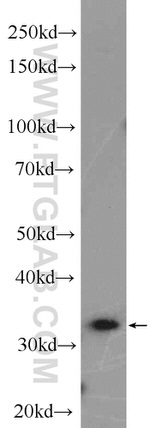 AIG1 Antibody in Western Blot (WB)