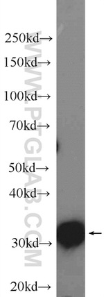 AIG1 Antibody in Western Blot (WB)