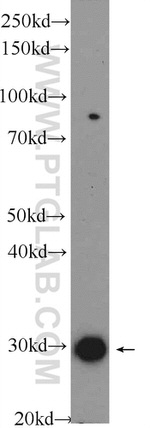 AIG1 Antibody in Western Blot (WB)