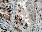 GSTA1 Antibody in Immunohistochemistry (Paraffin) (IHC (P))