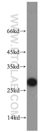 VAPB Antibody in Western Blot (WB)
