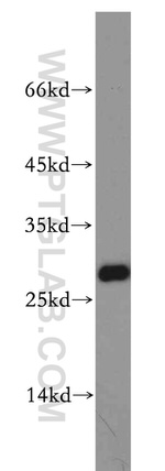 VAPB Antibody in Western Blot (WB)