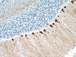 Calbindin-D28k Antibody in Immunohistochemistry (Paraffin) (IHC (P))