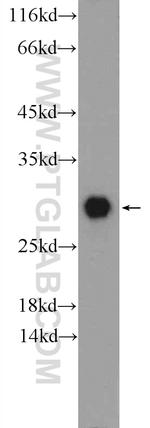 Calbindin-D28k Antibody in Western Blot (WB)