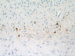 Calbindin-D28k Antibody in Immunohistochemistry (Paraffin) (IHC (P))