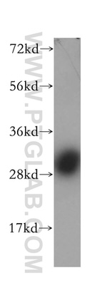 Calbindin-D28k Antibody in Western Blot (WB)