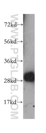 Calbindin-D28k Antibody in Western Blot (WB)