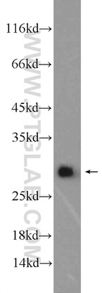 Calbindin-D28k Antibody in Western Blot (WB)