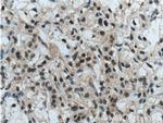 TFE3 Antibody in Immunohistochemistry (Paraffin) (IHC (P))
