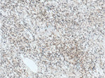 TFE3 Antibody in Immunohistochemistry (Paraffin) (IHC (P))