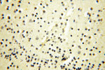 PNPT1 Antibody in Immunohistochemistry (Paraffin) (IHC (P))