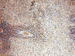 PNPT1 Antibody in Immunohistochemistry (Paraffin) (IHC (P))