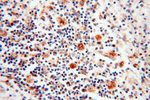 PNPT1 Antibody in Immunohistochemistry (Paraffin) (IHC (P))