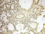 PNPT1 Antibody in Immunohistochemistry (Paraffin) (IHC (P))