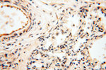 PNPT1 Antibody in Immunohistochemistry (Paraffin) (IHC (P))