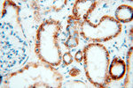 PNPT1 Antibody in Immunohistochemistry (Paraffin) (IHC (P))