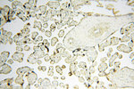 PNPT1 Antibody in Immunohistochemistry (Paraffin) (IHC (P))