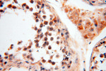 PNPT1 Antibody in Immunohistochemistry (Paraffin) (IHC (P))