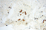 PNPT1 Antibody in Immunohistochemistry (Paraffin) (IHC (P))