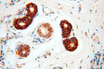 PNPT1 Antibody in Immunohistochemistry (Paraffin) (IHC (P))