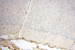 PNPT1 Antibody in Immunohistochemistry (Paraffin) (IHC (P))