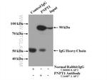 PNPT1 Antibody in Immunoprecipitation (IP)