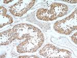 C9orf78 Antibody in Immunohistochemistry (Paraffin) (IHC (P))