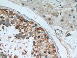 C9orf78 Antibody in Immunohistochemistry (Paraffin) (IHC (P))