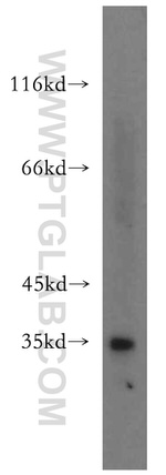 C9orf78 Antibody in Western Blot (WB)