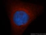 GSTM5 Antibody in Immunocytochemistry (ICC/IF)