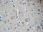 14-3-3 Antibody in Immunohistochemistry (Paraffin) (IHC (P))