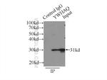 14-3-3 Antibody in Immunoprecipitation (IP)