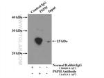 PSPH Antibody in Immunoprecipitation (IP)