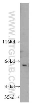 CREB3L2 Antibody in Western Blot (WB)