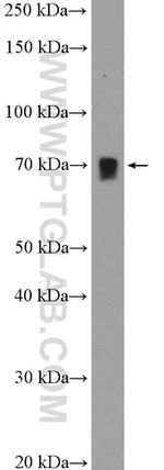 CREB3L2 Antibody in Western Blot (WB)